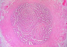 Image - World-first fallopian tube biobank provides new insights into failed pregnancies