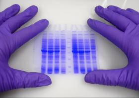 Image - Brace yourself, genetic testing might give you more than you bargained for